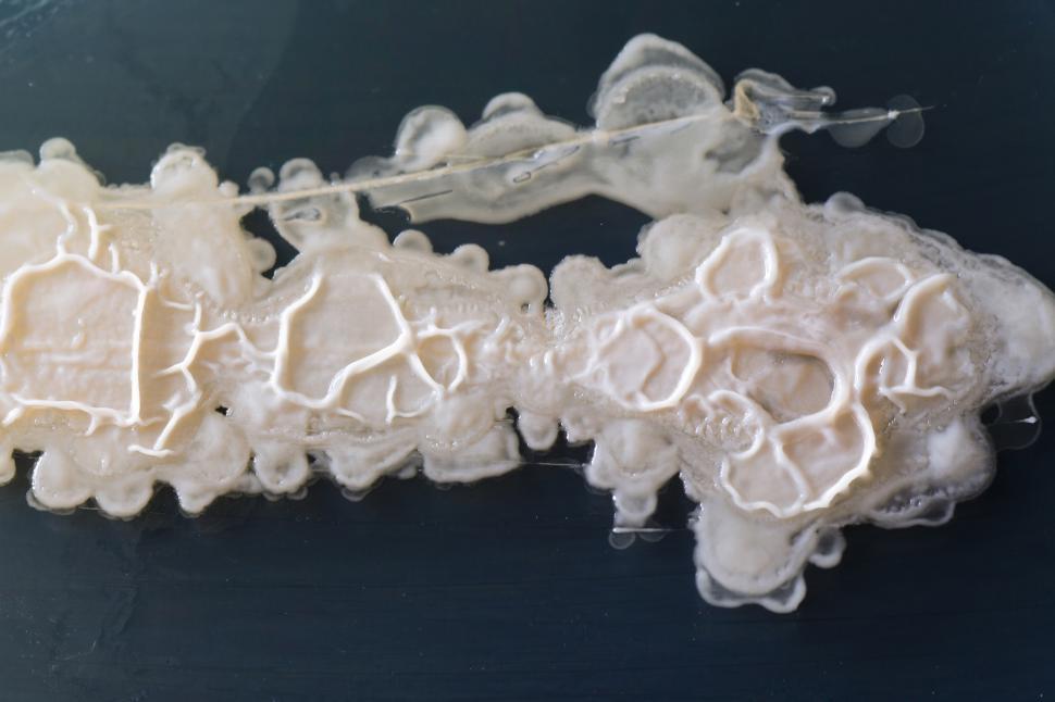 Free Image of Bacteria growing on a perti dish. 
