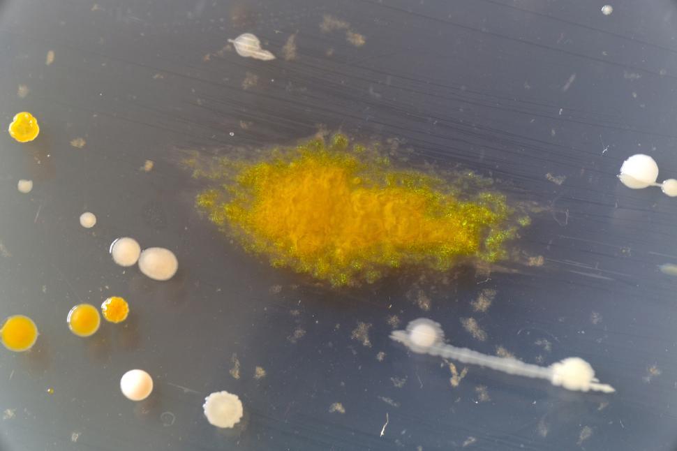 Free Image of Bacteria growing on a perti dish. 