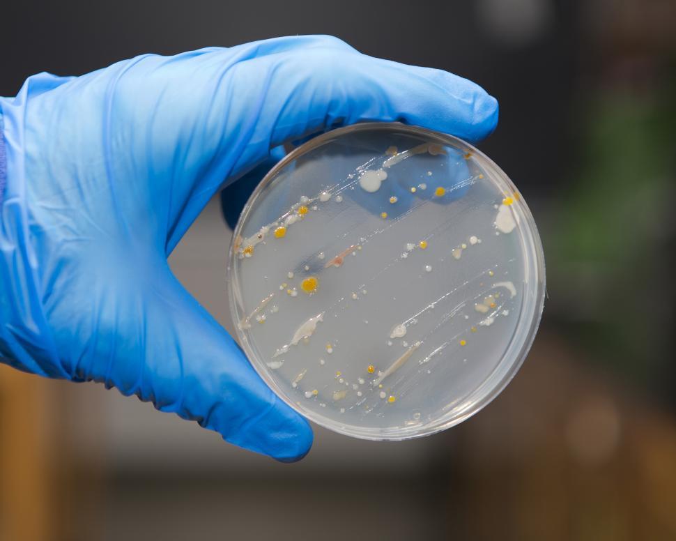 Free Image of Bacteria on an agar plate 