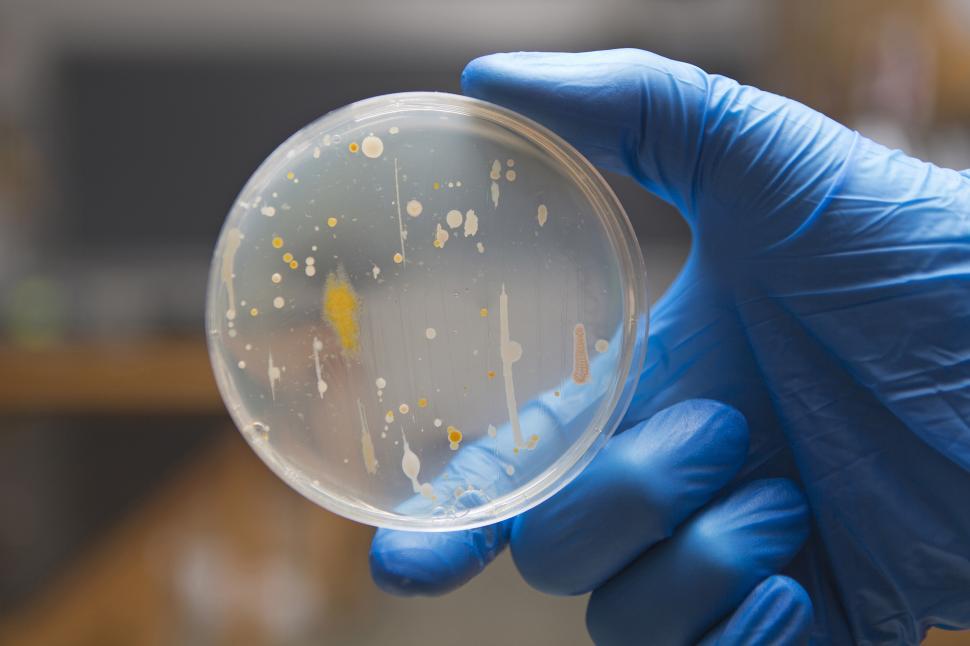 Free Image of Bacteria on an agar plate 