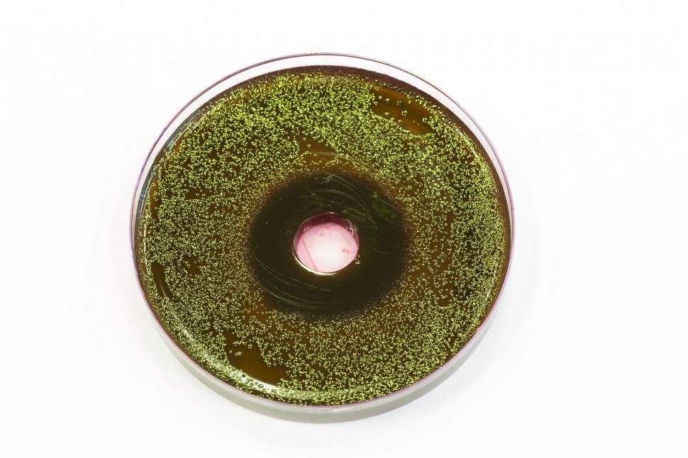 Free Image of Bacteria growing on EMB agar 