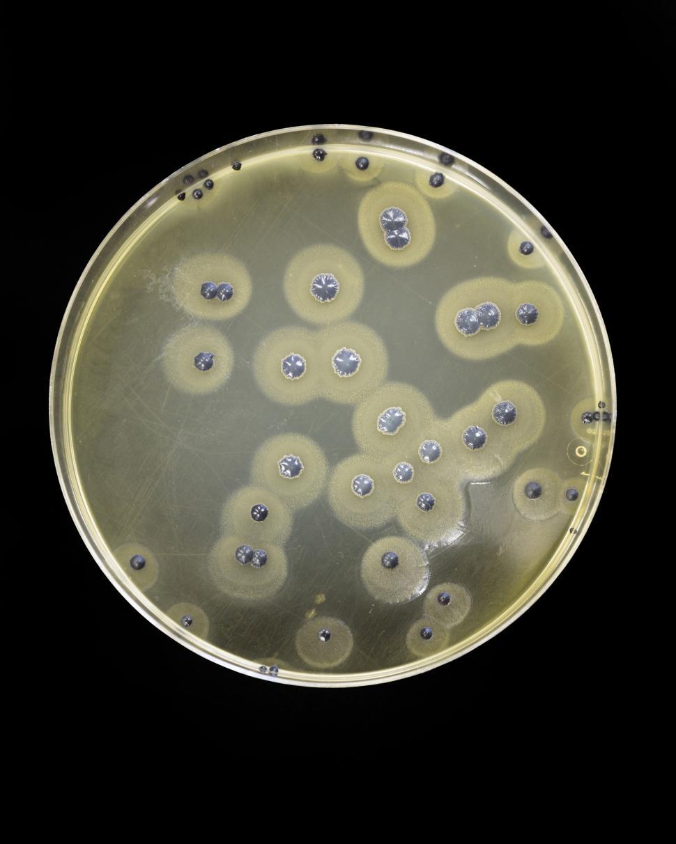 Free Image of Staphylococcus aureus  
