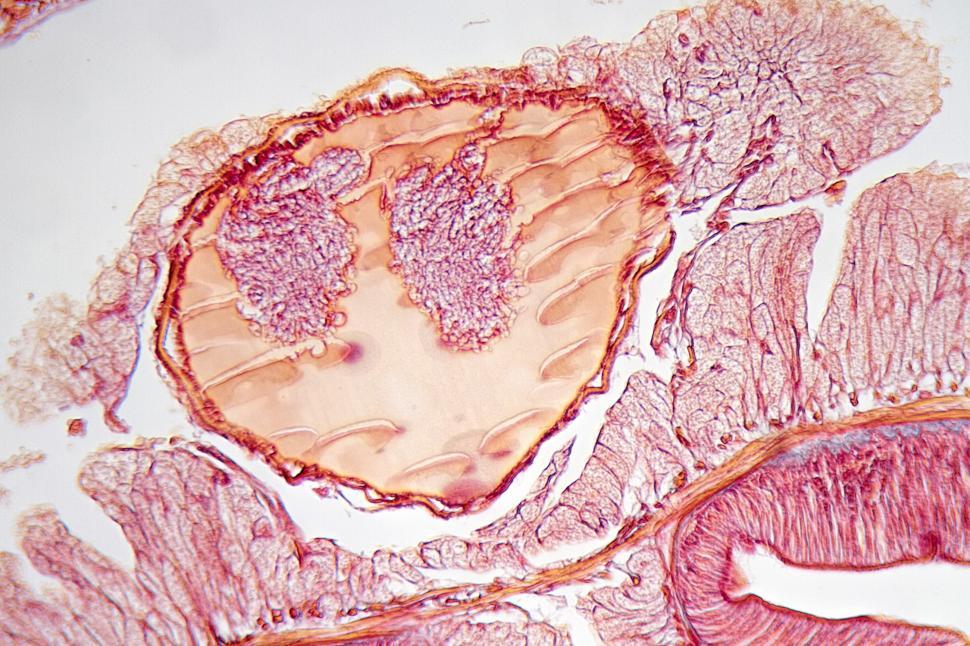 Free Image of Slide of earthworm 