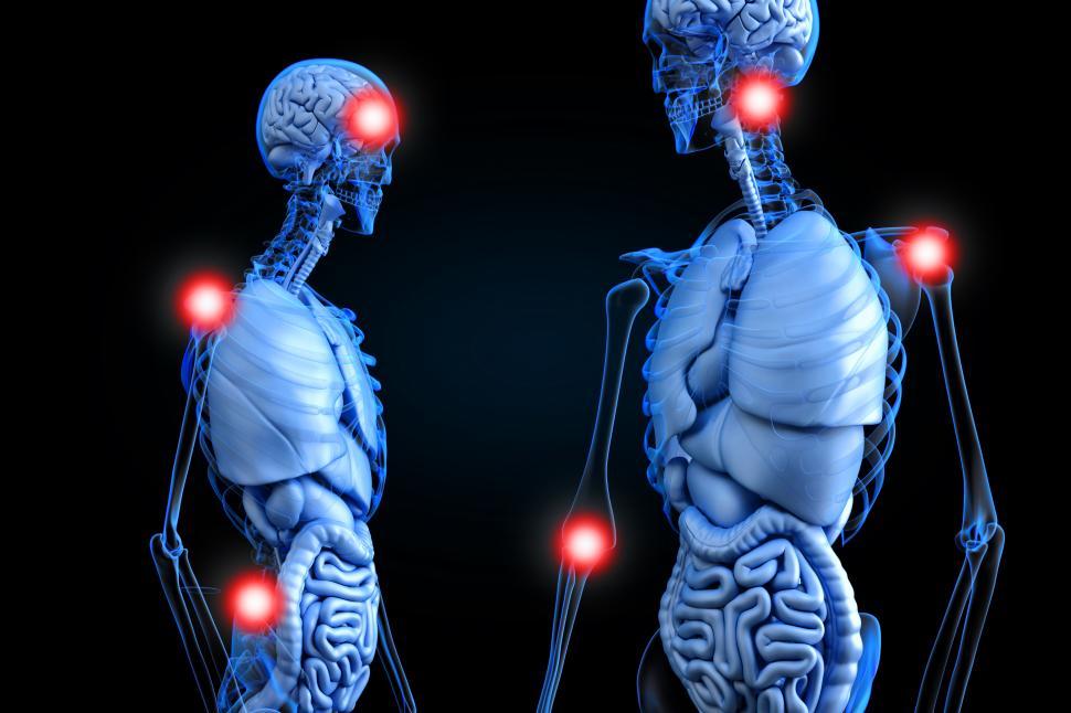 Free Image of Chronic Pain Points - Painful Areas in the Human Body 