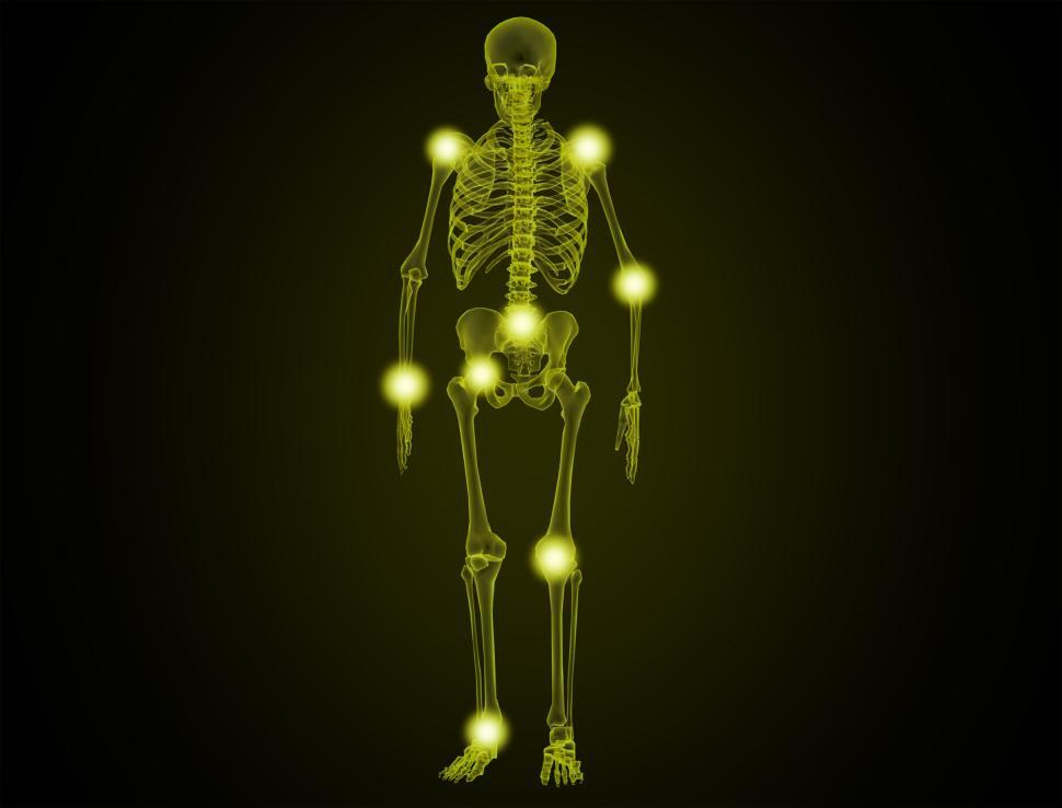 Free Image of Painful Joints - Illustration 